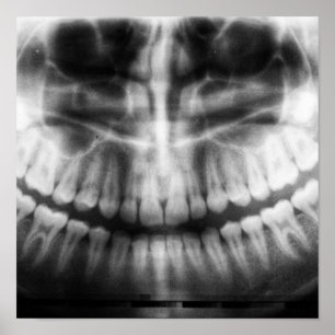 Affiche X-Ray Teeth Mouth Smile Black and White