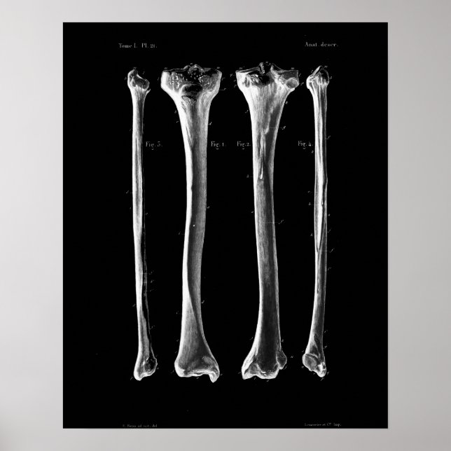 Affiches 1844 Anatomie Vintage Imprimer Tibia Fibula (Devant)