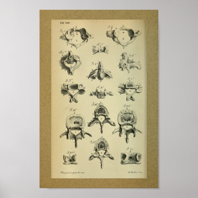 Affiches 1850 Anatomie Vintage Imprimer Vertèbre épinière (Devant)
