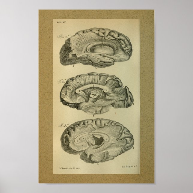 Affiches 1850 Vintage anatomie Imprimer Lobes Cerveau (Devant)
