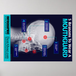 Affiches 5 raisons de porter un Mouthguard