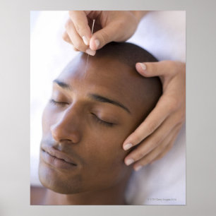 Affiches Acupuncture. Acupuncturiste insérant une aiguille