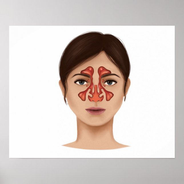 Affiches Anatomie Des Sinus Nasaux (Devant)