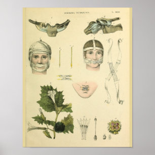 Affiches Anatomie Vintage de l'épaule