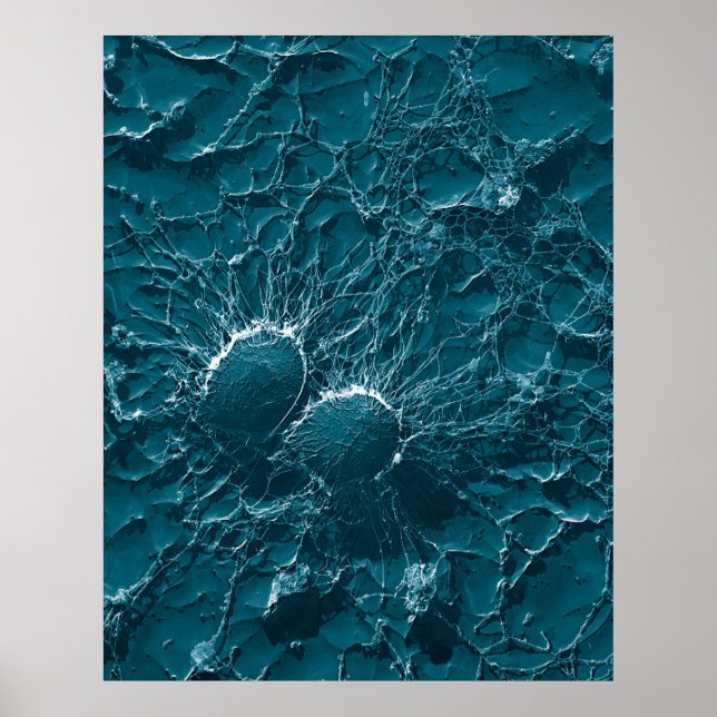 Affiches Cellules bactériennes de Staphylococcus Aureus Gro (Devant)