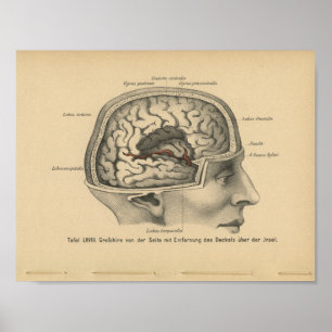 Affiches Cerveau de crâne d'impression d'anatomie