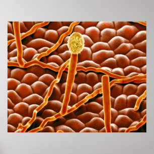 Affiches Champignon de rouille pulvérulente sur la