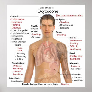 Affiches Chart of the Main Side Effects of Oxycodone