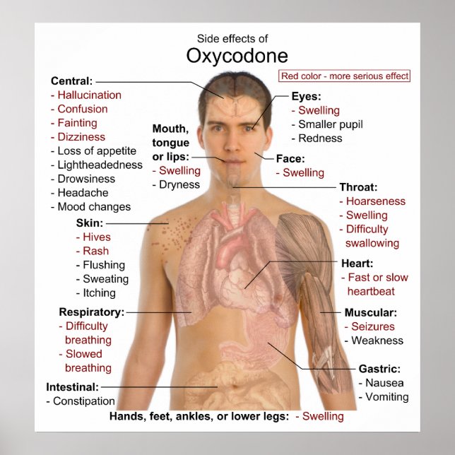 Affiches Chart of the Main Side Effects of Oxycodone (Devant)