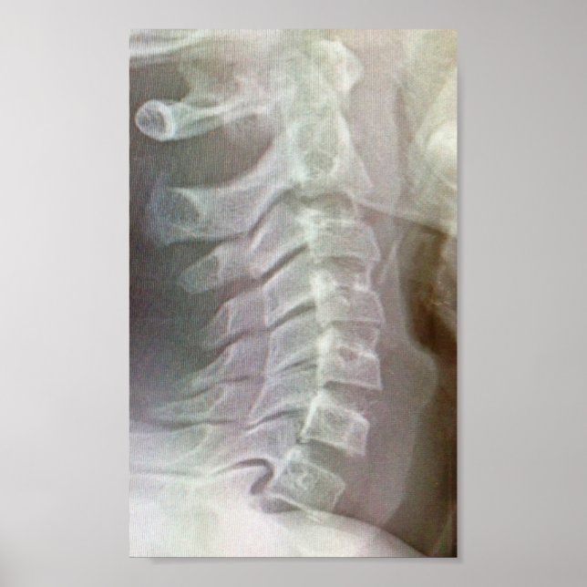 Affiches Cravate cervicale (Devant)