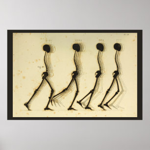 Affiches Diagramme de marche de chiropractie d'épine de