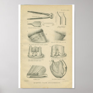 Affiches Fissures vintages de sabot d'impression d'anatomie