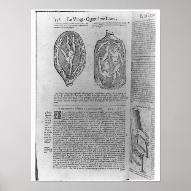 Affiches Foetus, illustration de 'Oeuvres' (Devant)