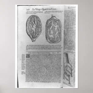 Affiches Foetus, illustration des 'oeuvres