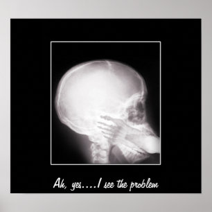 Affiches Foot à Mouth X-Ray