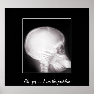 Affiches Foot à Mouth X-Ray