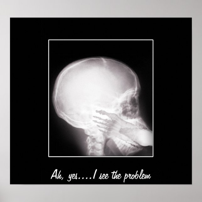 Affiches Foot à Mouth X-Ray (Devant)