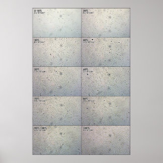 Affiches Graphique de suivi de confluence