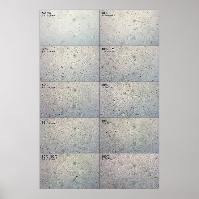 Affiches Graphique de suivi de confluence (Devant)