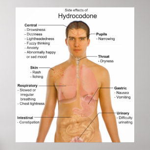 Affiches Graphique des effets secondaires de l'hydrocodone