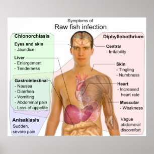 Affiches Graphique des symptômes d'une infection à poisson