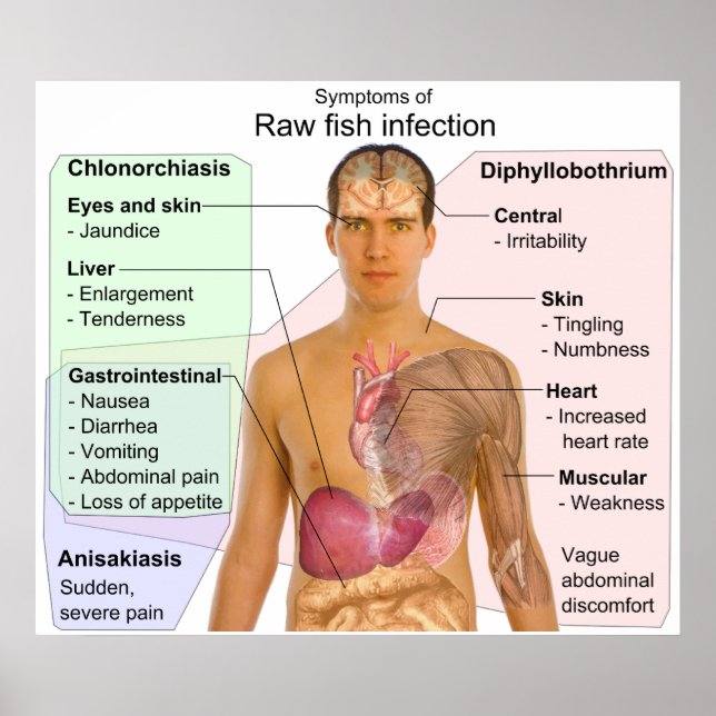 Affiches Graphique des symptômes d'une infection à poisson  (Devant)