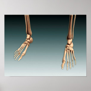 Affiches Image conceptuelle des os dans les jambes et les