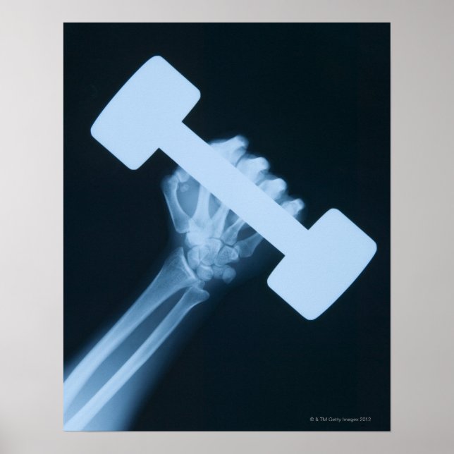 Affiches Image par rayons X de la main humaine avec poids,  (Devant)