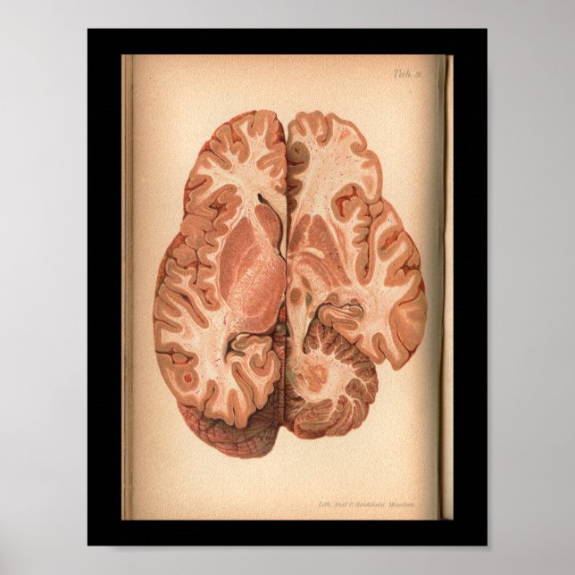 Affiches Imprimer l'anatomie cérébrale vintage de 1901 (Devant)