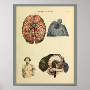 Affiches Le cerveau humain Intestins Anatomie Art Imprimer