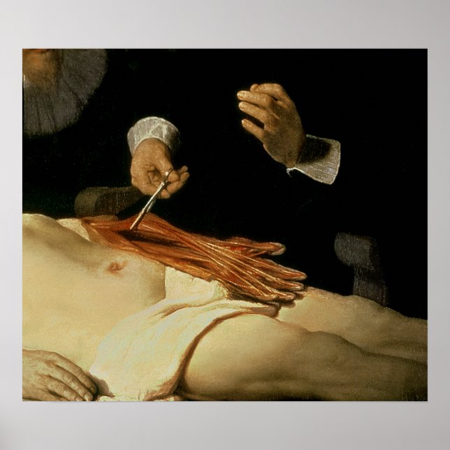 Affiches Leçon d'anatomie du Dr Nicolaes Tulp, 1632 (Devant)