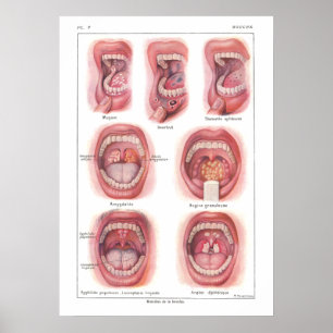 Affiches Les maladies du Français d'affiche d'anatomie de