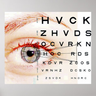 Affiches ophthalmologie