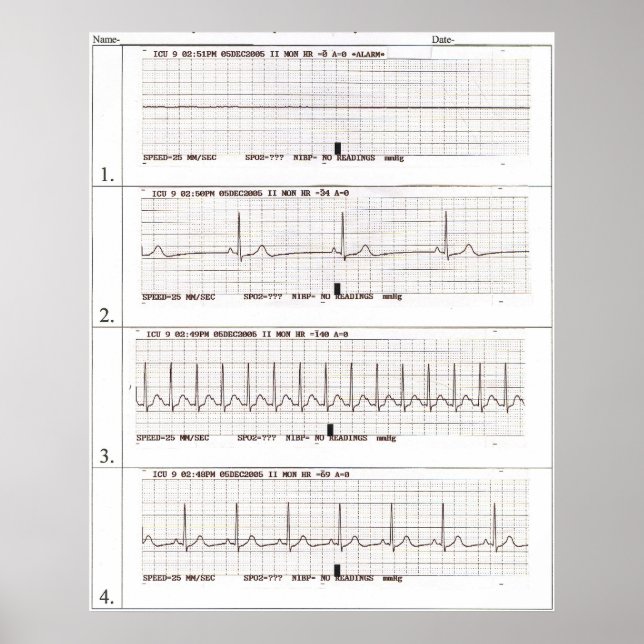 Affiches rythmes ekg (Devant)