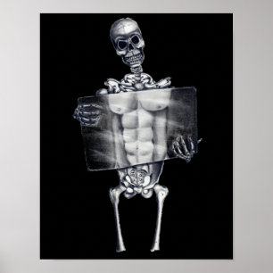 Affiches squelettiques de radiographie de la