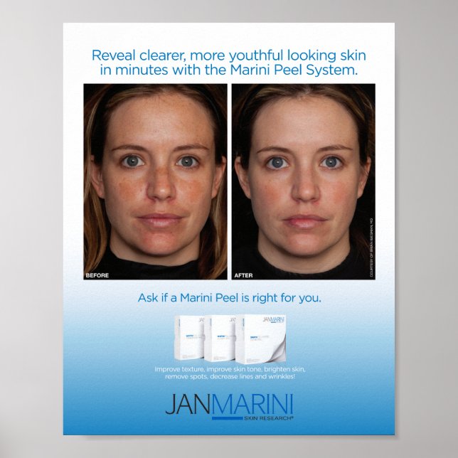 Affiches Système Peel Marini 8x10" (Devant)