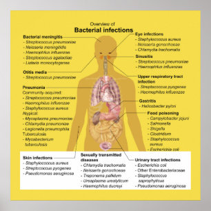 Affiches Vue d'ensemble des infections bactériennes