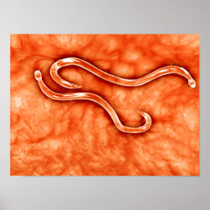 Affiches Vue Microscopique De Hookworm 2