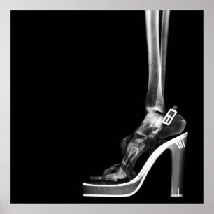 AFFICHES XRAY HIGEL LADY SKELETON FOOT B&W