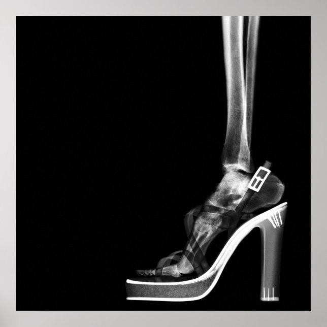 AFFICHES XRAY HIGEL LADY SKELETON FOOT B&W (Devant)