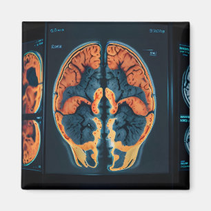 Aimant Analyse cérébrale par IRM