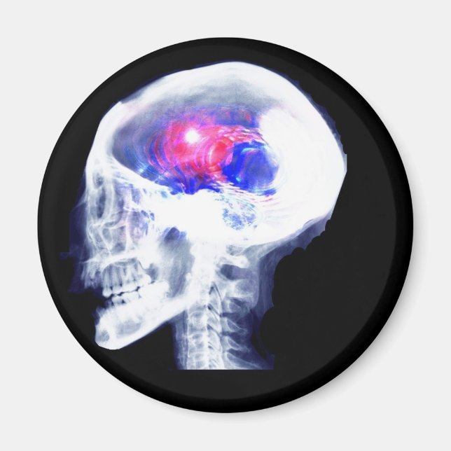 Aimant Cerveau Cyborg (Devant)
