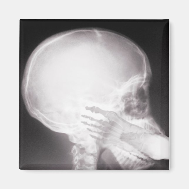 Aimant Foot à Mouth X-Ray (Devant)