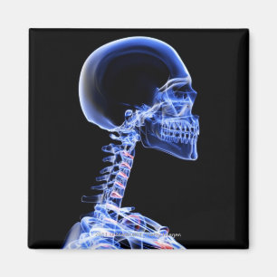 Aimant Rayon X des os dans le cou