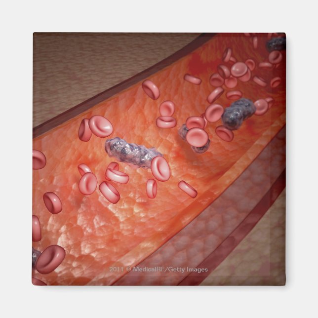 Aimant Rendu microscopique d'une infection sanguine (Devant)