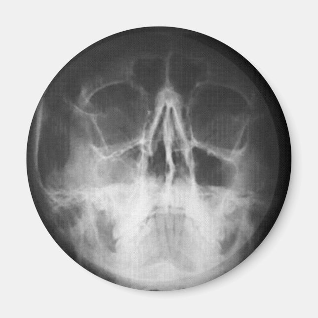 Aimant Skully Top Fun (Devant)