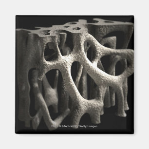 Aimant Structure d'un os avec ostéoporose