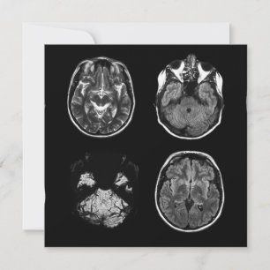 Analyse IRM du cerveau