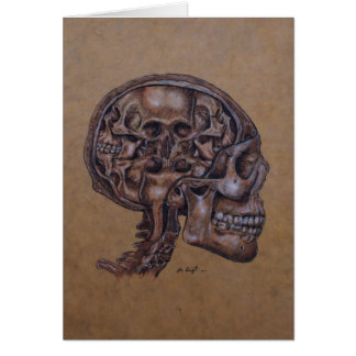 Anatomie d'un schizophrène