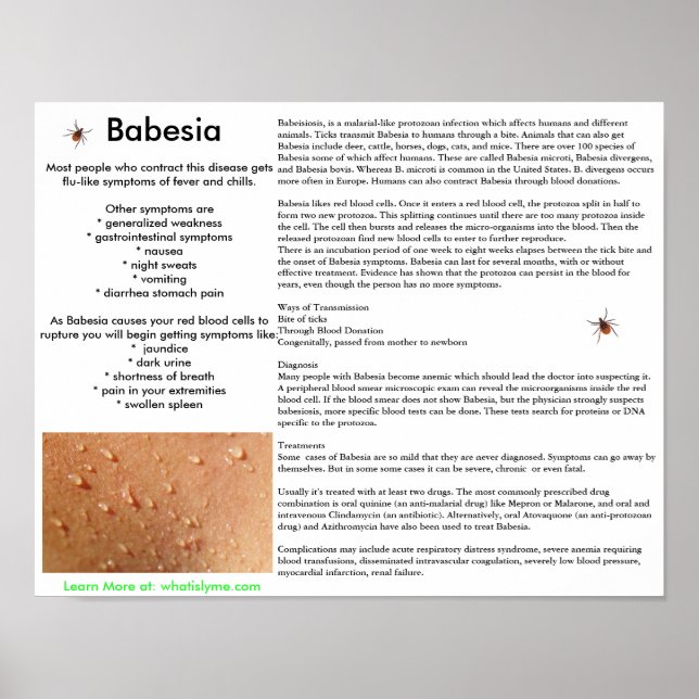 Babesia Symptômes and Transmission Poster (Devant)
